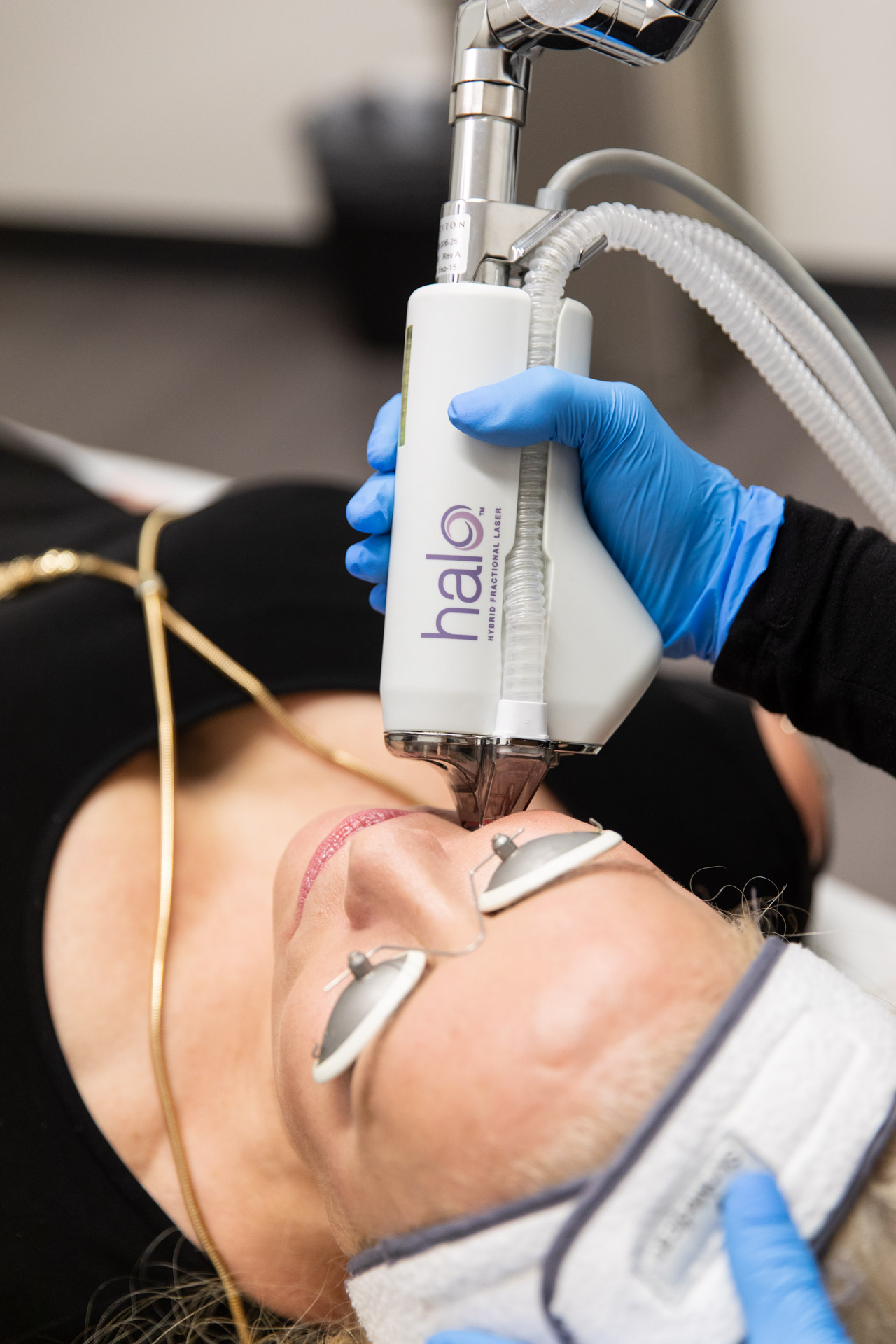 HALO Laser Treatment