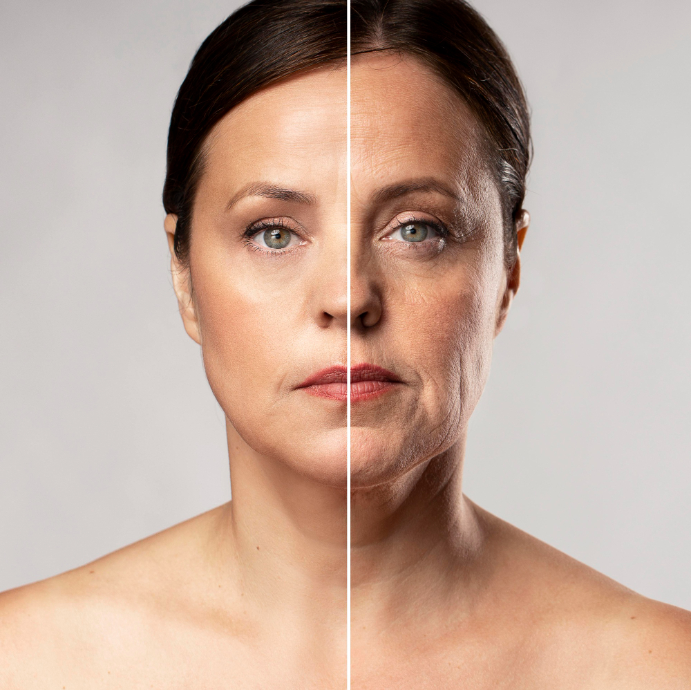 Skin Tightening Options